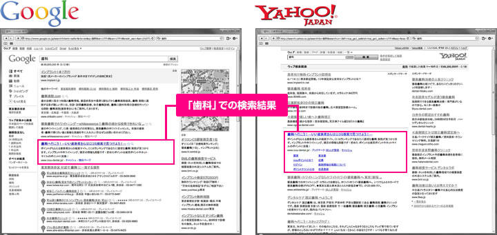 検索エンジン検索結果